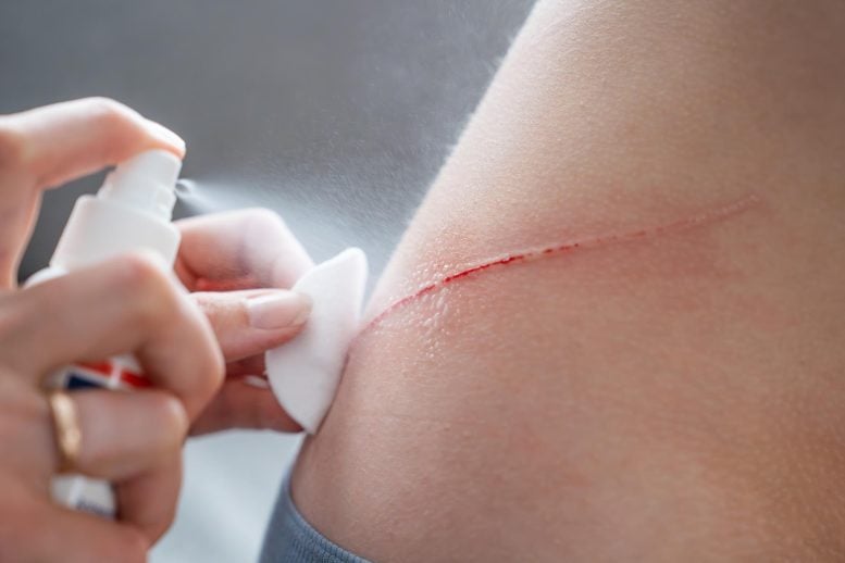 Spray Antiseptic Cut Scratch Wound