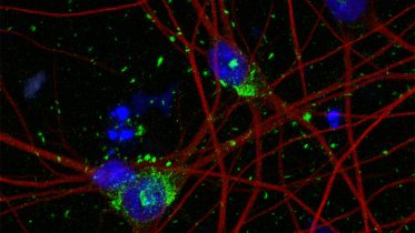 Revolutionizing Alzheimer’s Research: Cornell Scientists Develop Groundbreaking Neuron Model