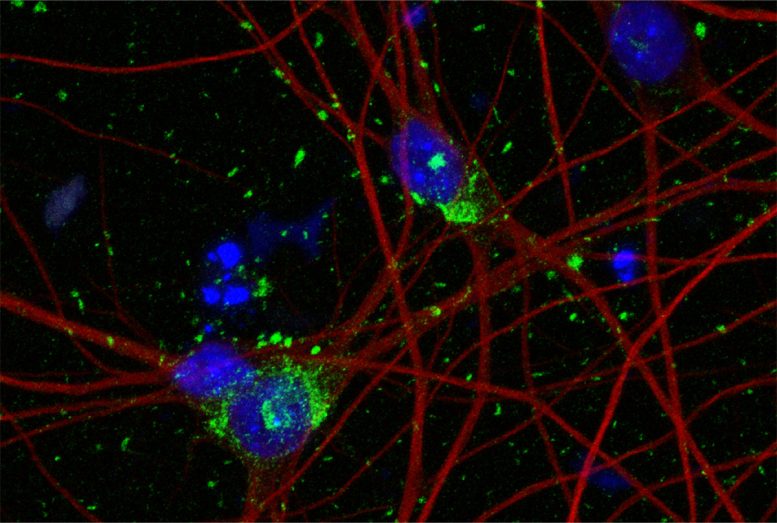 Coloração de neurônios derivados de células-tronco humanas mostra DNA em núcleos celulares, citoesqueleto de neurônios e agregados de Tau