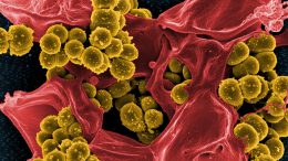 Staphylococcus aureaus