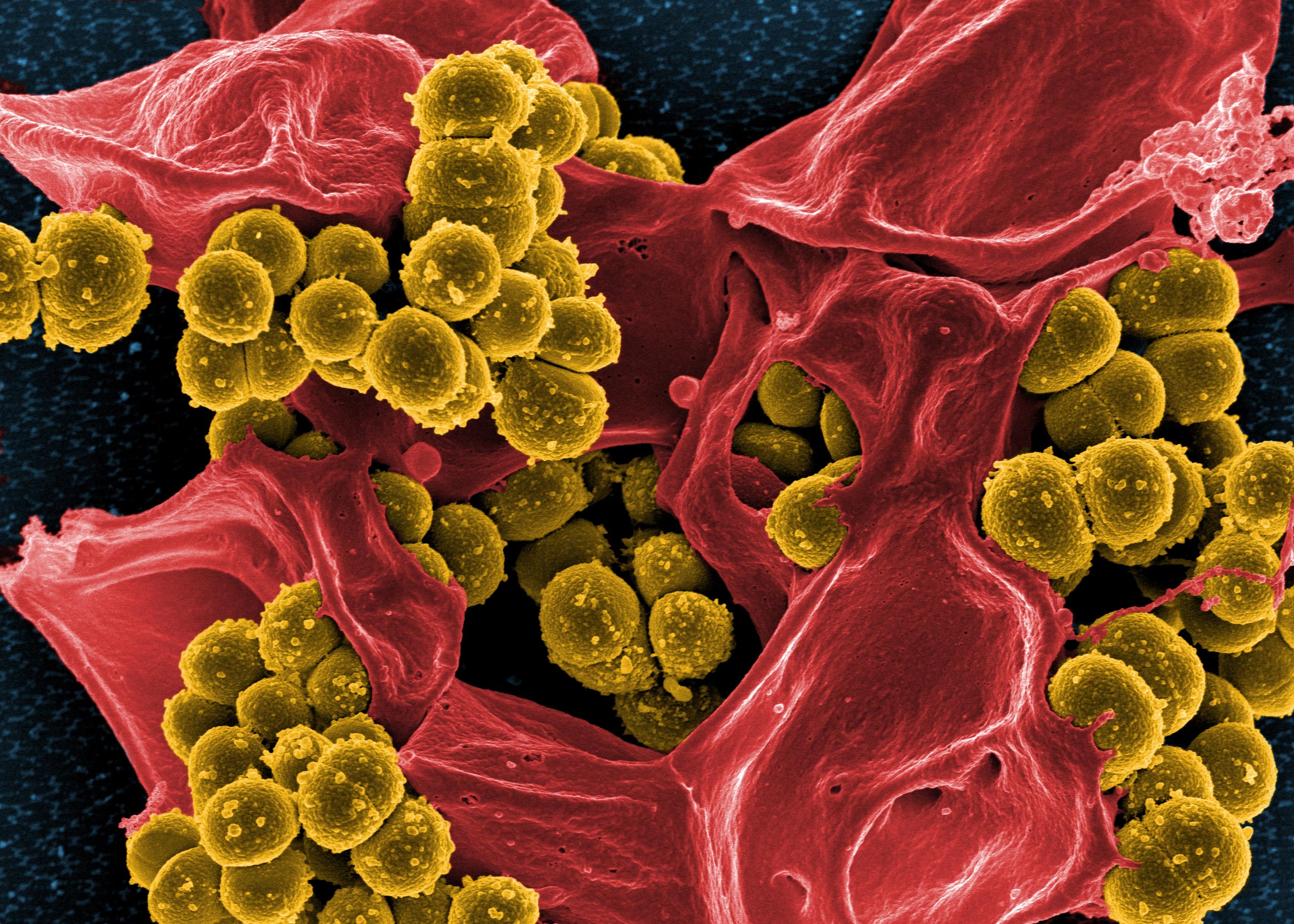 Staphylococcus: From Harmless Skin Bacteria to Deadly Pathogen