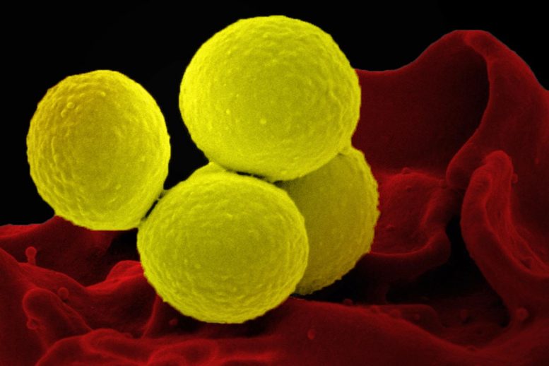 Staphylococcus aureus Bacteria SEM