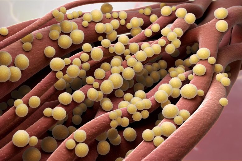 Staphylococcus aureus Illustration