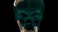 Static Skull, Mandible, and Parietal Orthographic