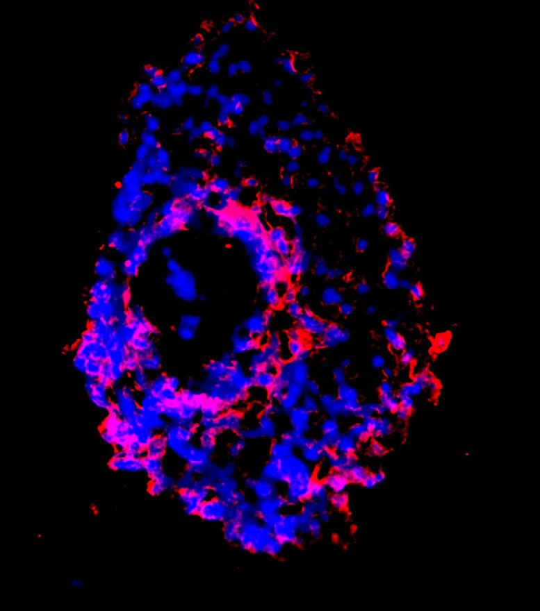 Stem Cell-Derived Tear Glands
