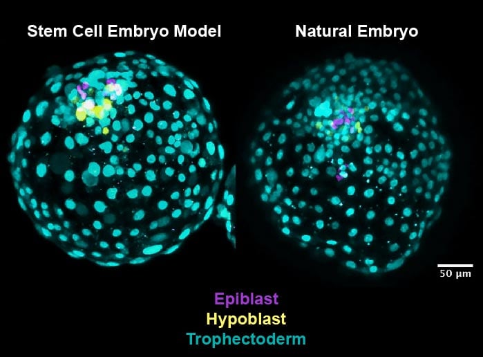 Stem Cell Embryo Model