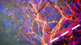 Stem Cell Innovation Could Treat Parkinson’s