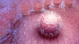 Stem Cells Found in Umbilical Cord Blood