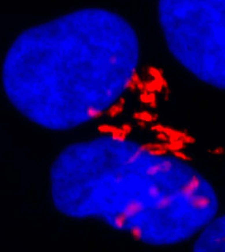 Stem Cells Poised to Self-Destruct
