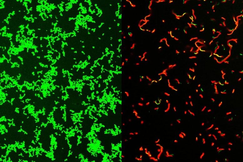 Streptococcus pyogenes מטופל עם GmpCide