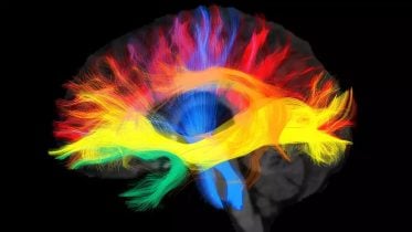 The Language We Speak Shapes the Connectivity in Our Brains