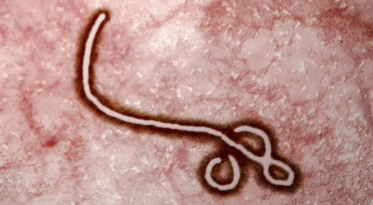 Study Questions 21 Day Quarantine For Ebola