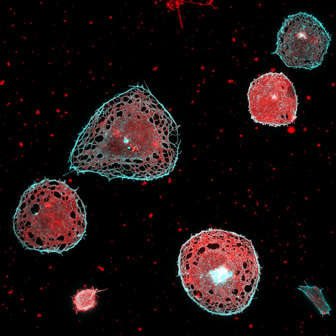 Researchers Develop HighSpeed SuperResolution Microscope With a Large