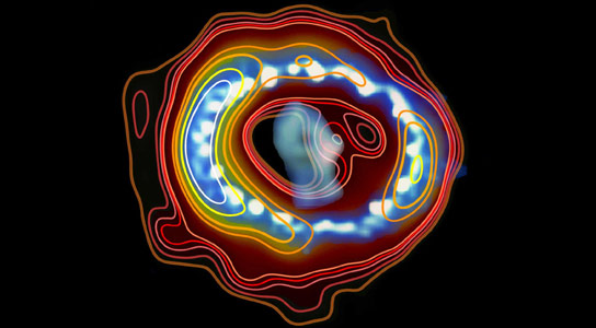 Supernova Remnant 1987A Continues to Reveal Secrets