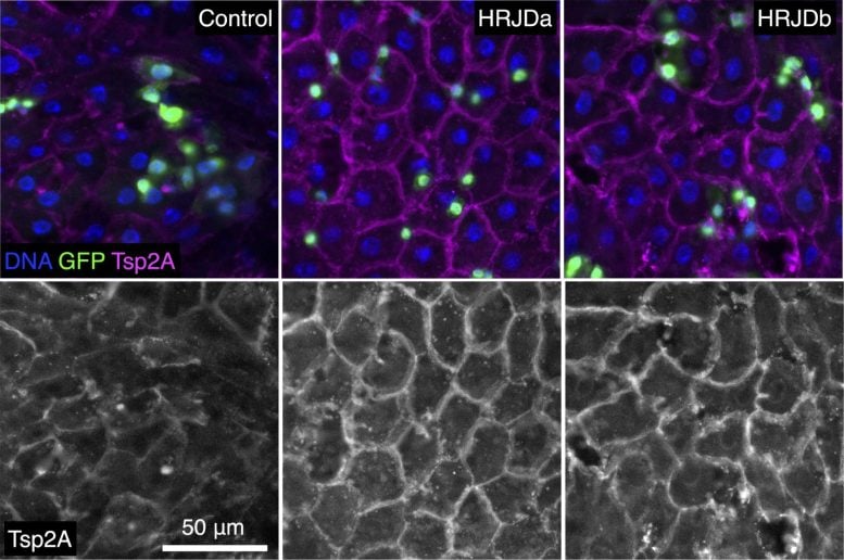 Suppressing Gut Barrier