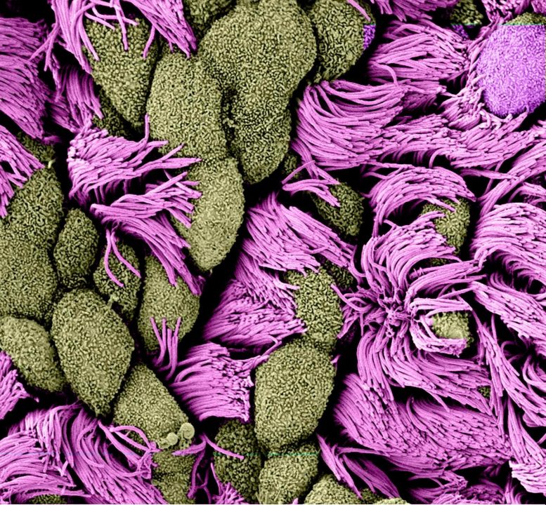 Surface of a Multicillated Cell