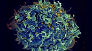 T Cells HIV Virus