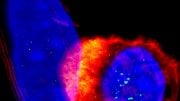 T Cells Targeting Tumor Cells