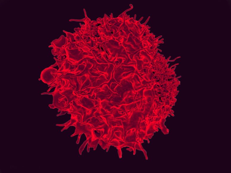 T Lymphocyte Colorized Scanning Micrograph