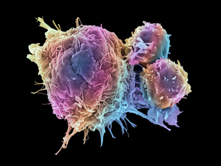 T Lymphocytes and Cancer Cell