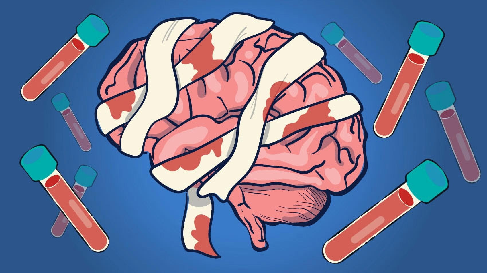 Early Blood Tests for Traumatic Brain Injury Can Accurately Predict Which Patients Are Likely To Die – europeantimes.news - Vimarsana News