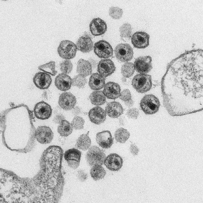 תמונת מיקרוסקופיה של TEM של חלקיקי HIV