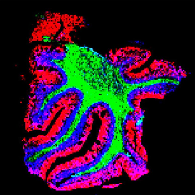 TEMI Mapping of Lipid Distribution Across Cerebellar Layers