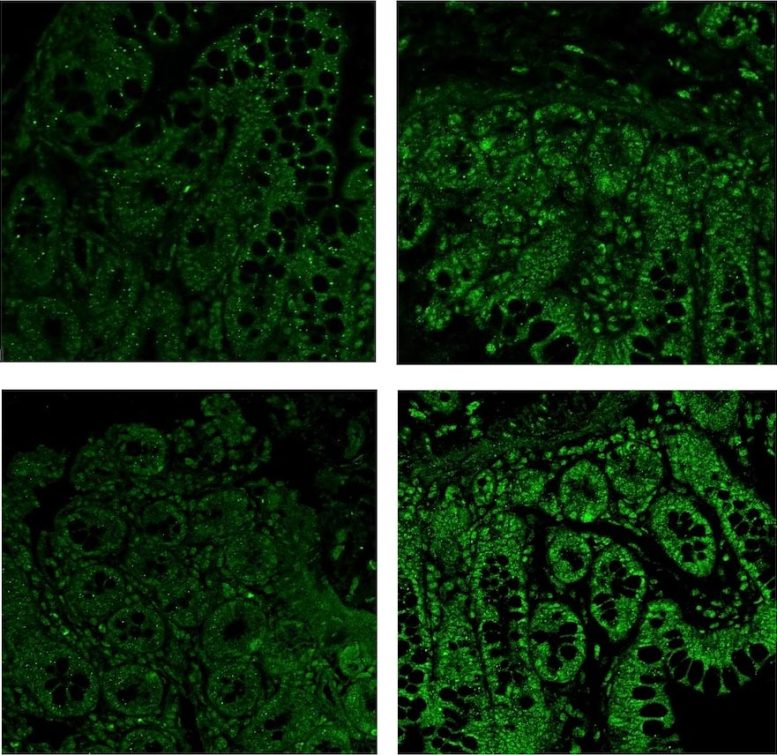 THC Serotonin Receptors in Gut