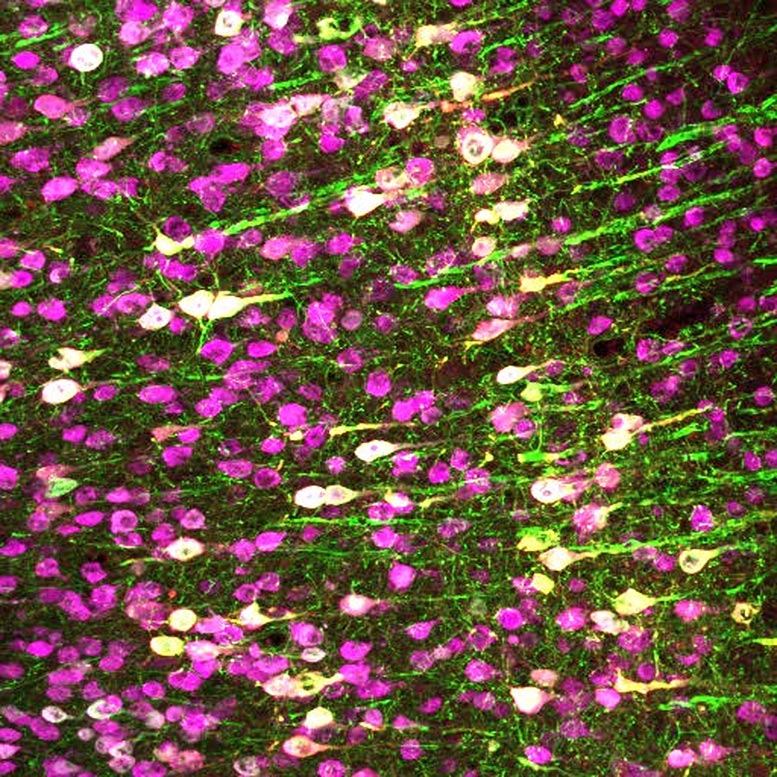TRPA1 Neurons in Mouse Brain