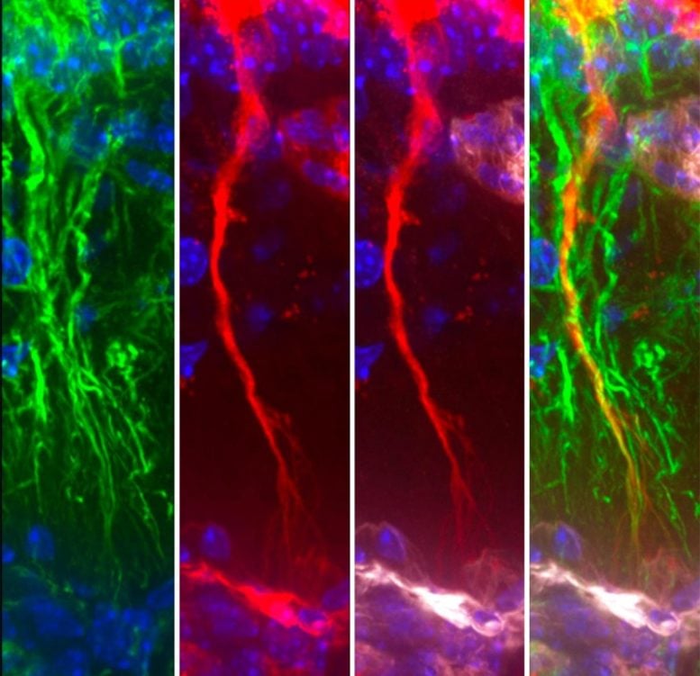 Scientists Discover Hidden Brain Cells That Remove Toxic Alzheimer’s Protein