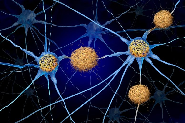 Tau Tangles Amyloid Beta Neuron Cells Brain Alzheimers Dementia