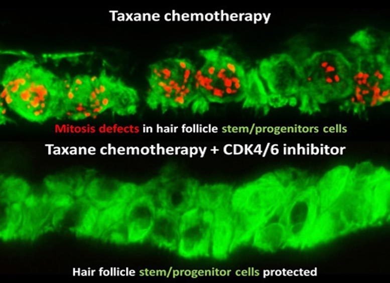 Taxane Chemotherapy CDK46 Inhibitor