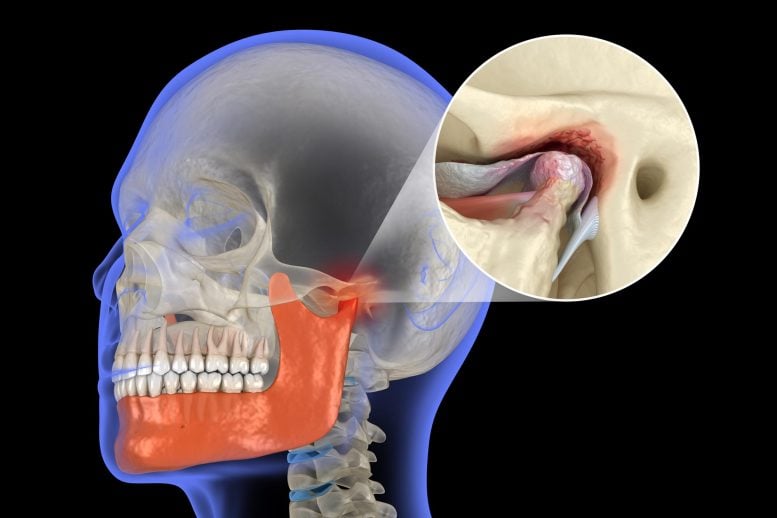 New Enzyme Discovery Could Protect Jaw Cartilage and Stop Arthritis