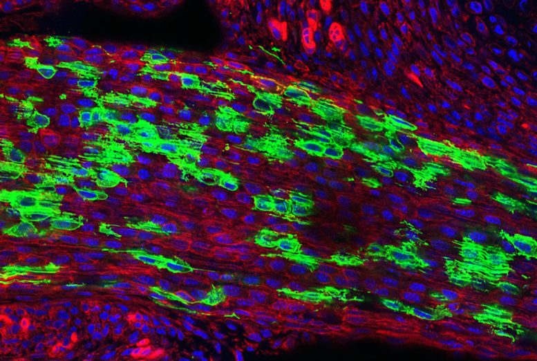 Tendon Stem Cells in Mouse Achilles Tendon