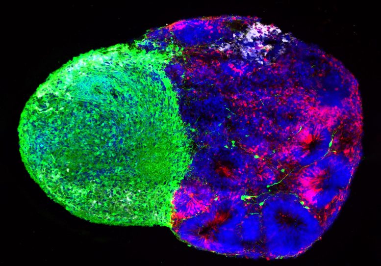 Thalamic and Cortical Organoids