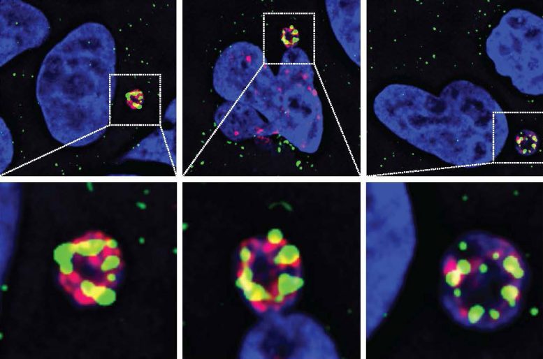 The Beginnings of Chromothripsis in Colorectal Cancer Cells