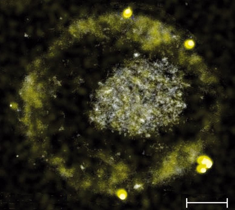 These Bacteria Produce Gold by Digesting Toxic Metals