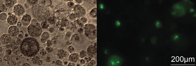 Three Dimentional Lung Cancer Spheroids Transfected With Green Fluorescent Labelled ASOs