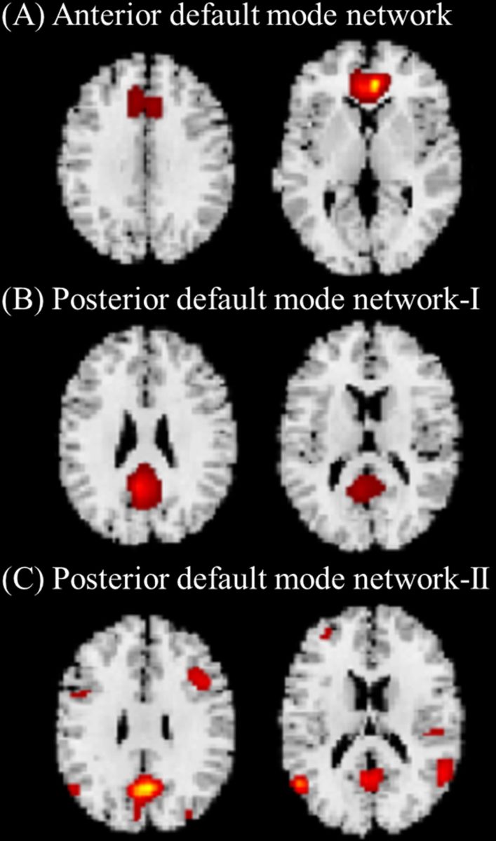Three Gray Matter Structural Networks Related to Default Mode Network