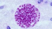 Toxoplasma-gondii