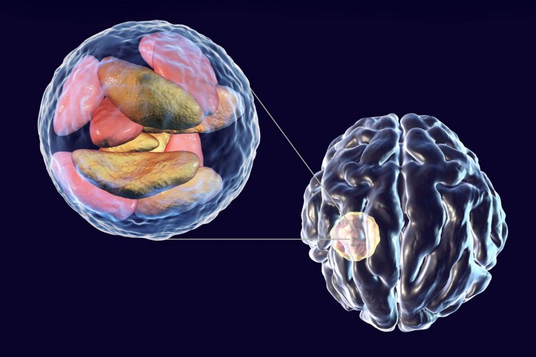 Toxoplasma gondii Brain