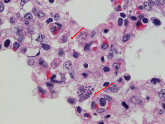Toxoplasma-gondii-pig-lung
