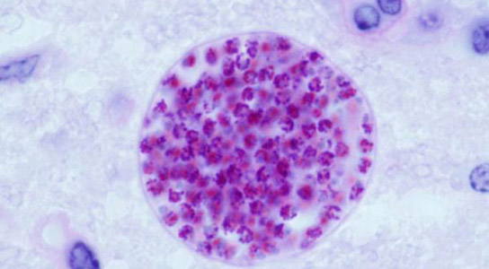 Toxoplasma-gondii