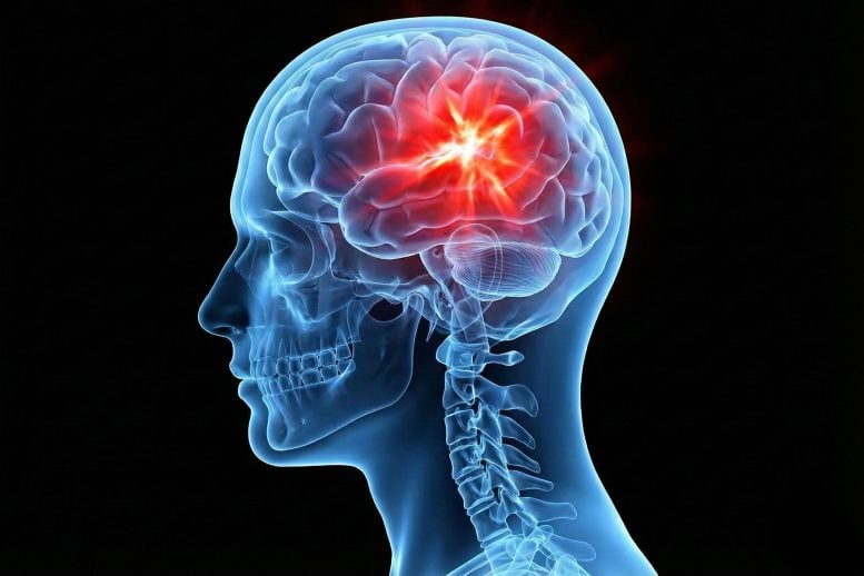 Traumatic Brain Injury