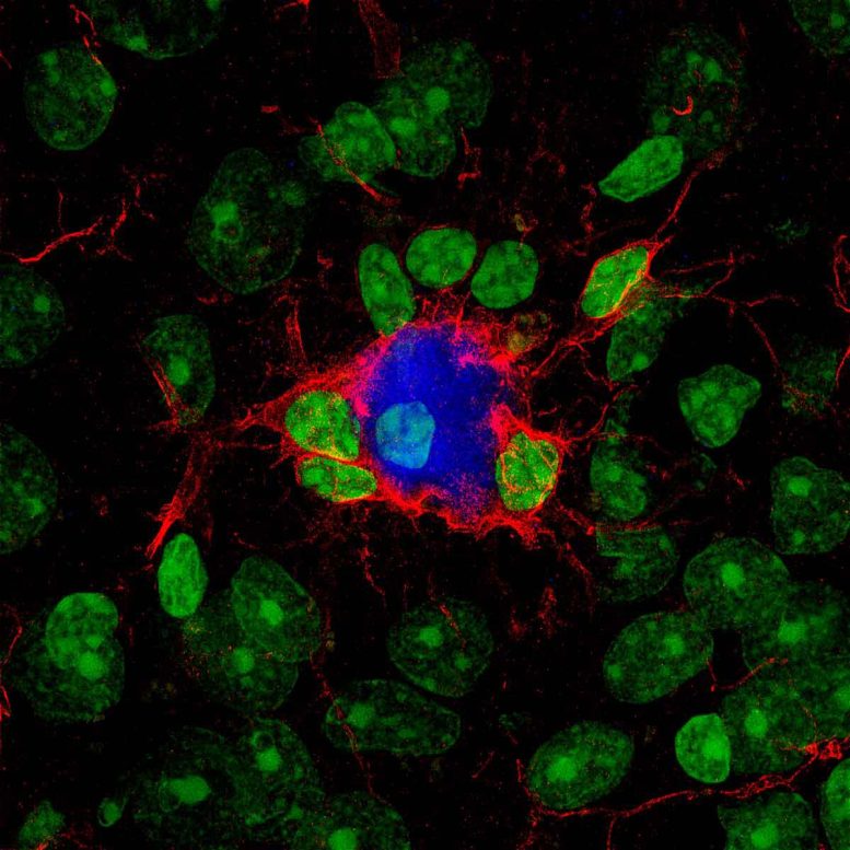 Treated Microglia Reduce Amyloid Plaques