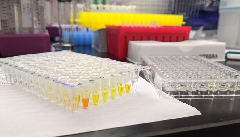 Tuberculosis Test Tubes Lab