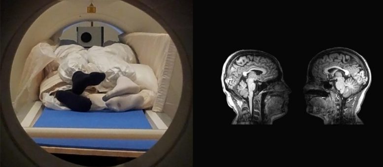 Two Person MRI Scan