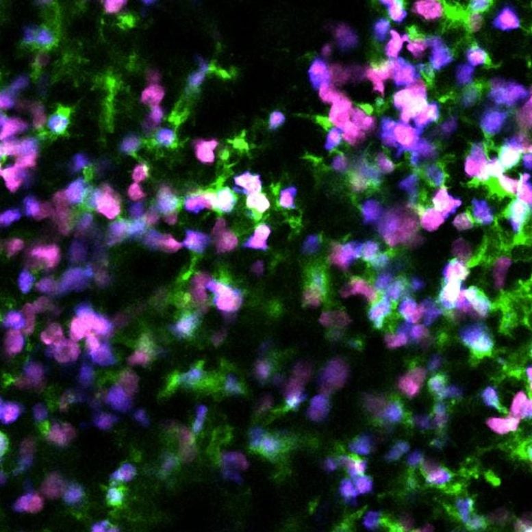 Osservazione della morte delle cellule cancerose mediante imaging a due fotoni