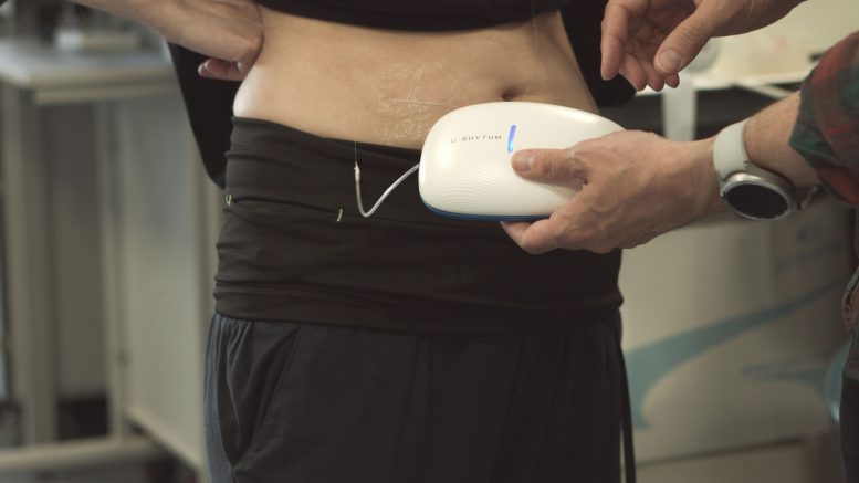 U RHYTHM Device Attached to Waist