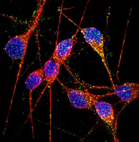 UC San Diego Scientists Create Stem-Cell-Derived Neurons from Alzheimer’s Disease